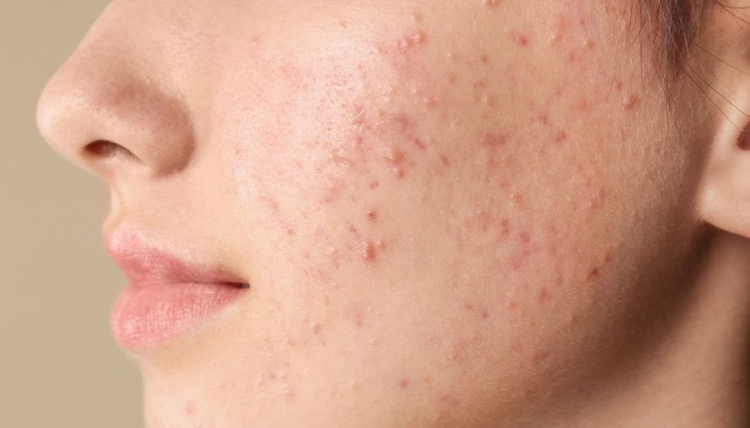 Hình ảnh liệu trình chăm sóc tại CGlow Spa
