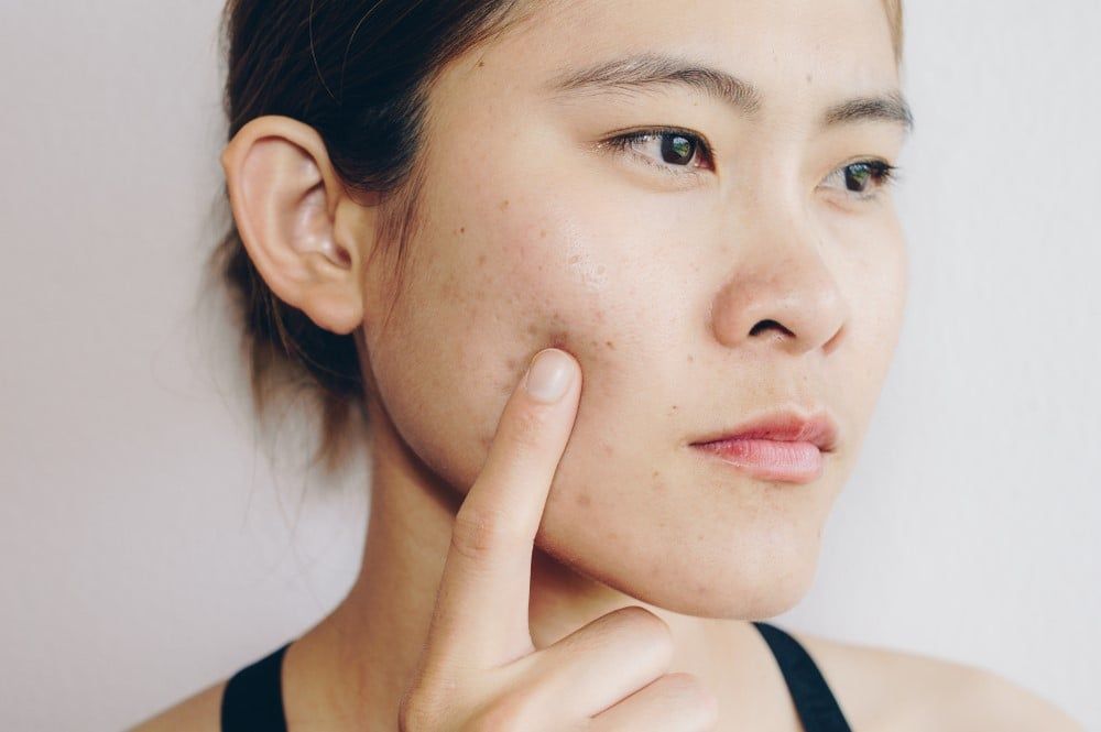 Da nhiễm độc bị sần sùi bong tróc