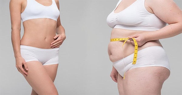 Bao lâu nên làm liệu trình giảm mỡ 1 lần? Sự thật nhiều người hiểu sai